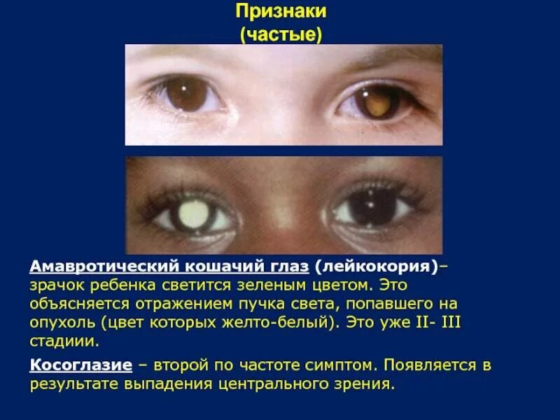 Зрачки после наркоза