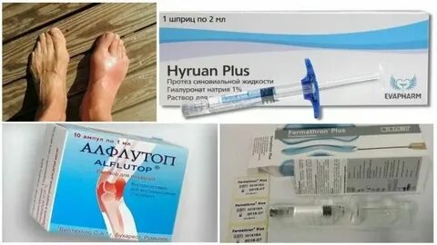 Уколы от подагры лучшие