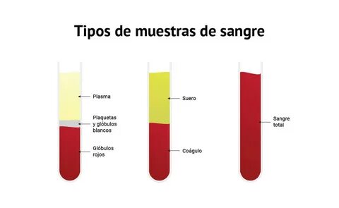 De sangre