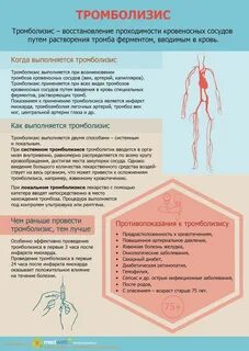 Тромб после инфаркта