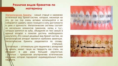 Можно ли пить с брекетами