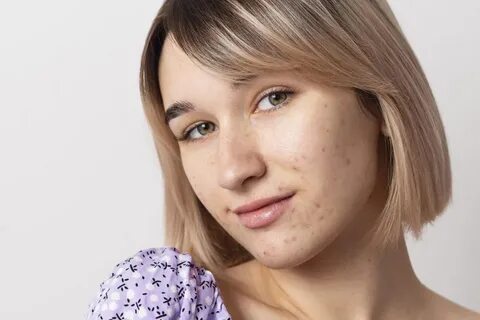 Lxnwave лицо