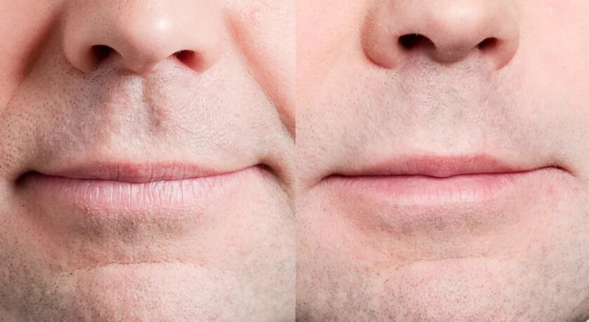 Губы мужчины характеристика. Тонкие мужские губы. Тонкие губы у мужчины. Узкие мужские губы. Маленькие губы у мужчин.
