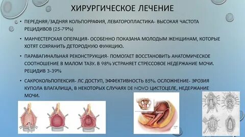 Сколько времени проводится операция