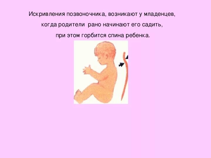 Ребенок со спины. Сколиоз рисунок. Кифоз шейно грудного отдела позвоночника. Формирование изгибов позвоночника. Позвоночник новорожденного ребенка.