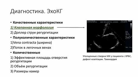 Эхо кг в туле