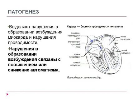 Нарушение проводящей системы
