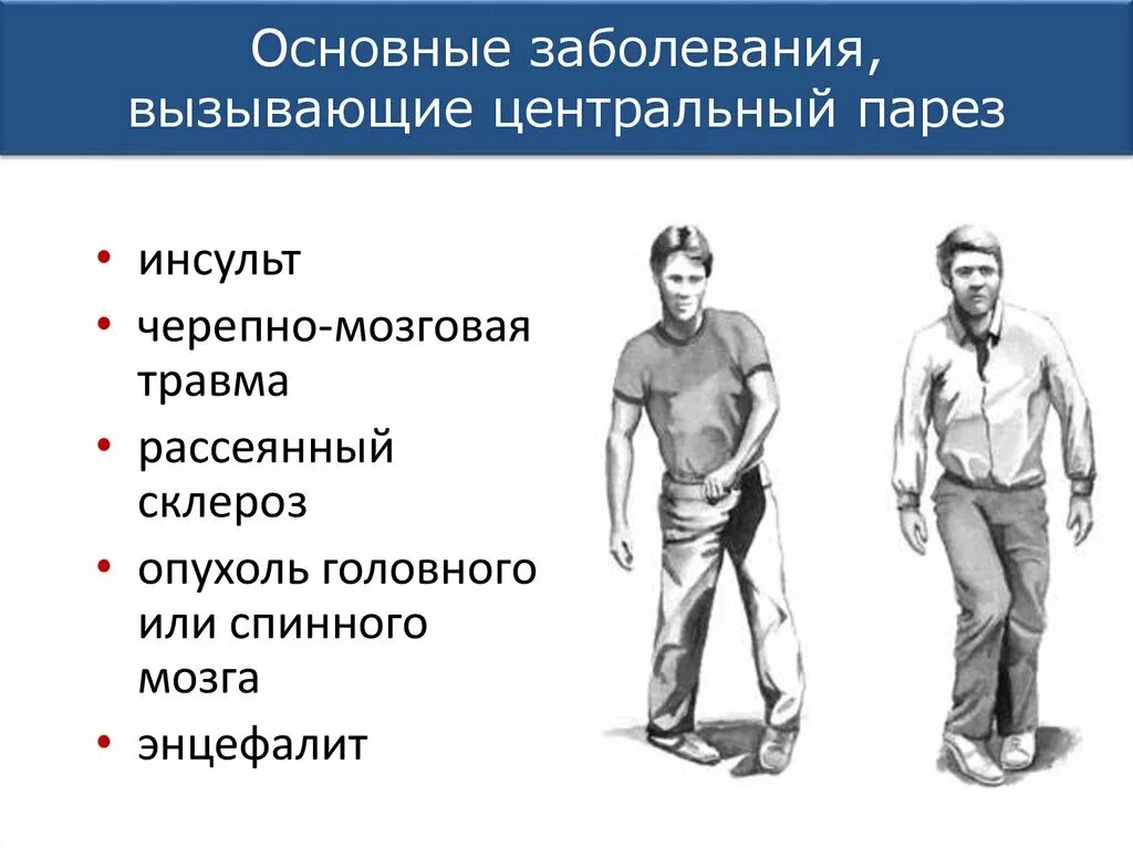 Парез латынь. Классификация парезов и параличей. Центральный и периферический парез. Парез это в неврологии. Парезы классификация неврология.