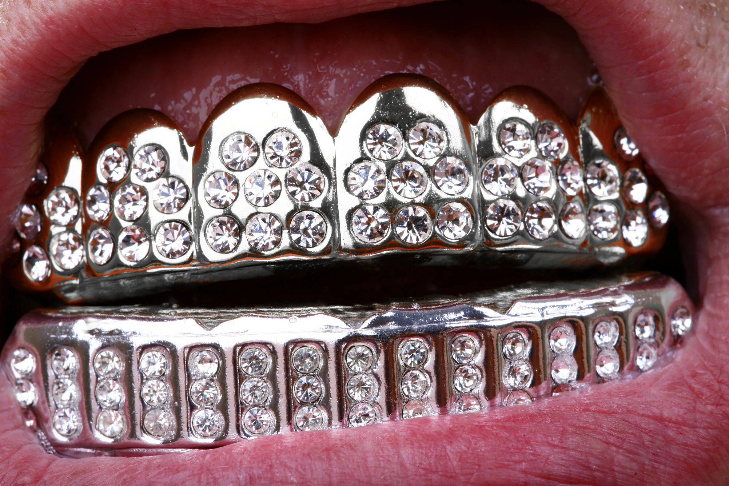 Сколько стоит металлические зубы. Грилзы Бриллиантовые. Грилзы серебряные. Бриллиантовые зубы.