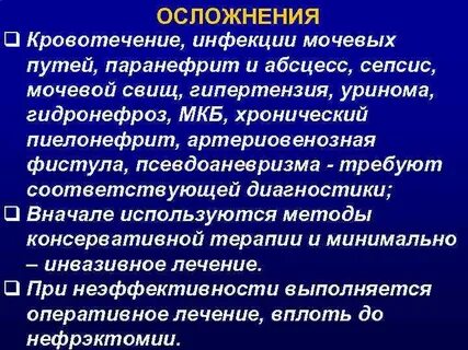 Гидронефроз мкб