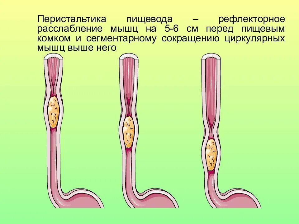 Волнообразные сокращения стенки. Перистальтические сокращения пищевода. перистальтические волны пищевода. нарушение моторики пищевода.