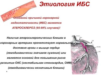 В основе патогенеза ишемической болезни сердца