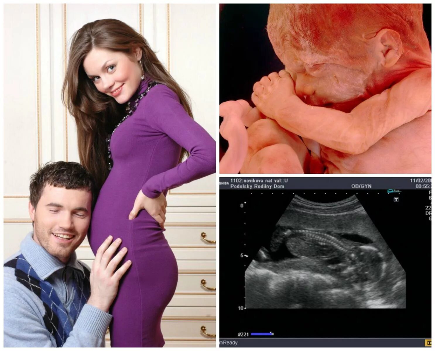Можно почувствовать шевеление на 15 неделе. 15 Недель беременности. 15 Недель беременности фото ребенка. Плод на 15 неделе беременности.