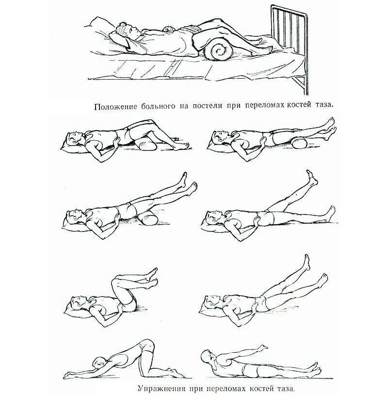 Лечебная физкультура после перелома лонной кости таза. Лечебная физкультура при переломе костей таза. ЛФК по 2 комплекс при компрессионном переломе позвоночника. Лечебная гимнастика после перелома костей таза. Массаж после операции на позвоночнике