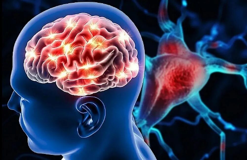 Преходящее острое нарушение мозгового кровообращения. Инсульт нарушение мозгового кровообращения. Распознавание симптомов инсульта. Классификация острых нарушений мозгового кровообращения. Нарушение мозгового кровообращения.