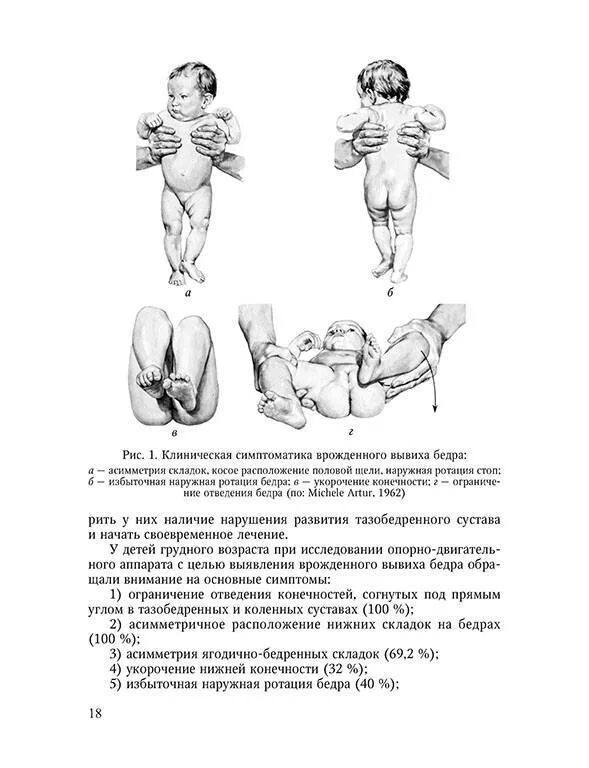 Норма тазобедренного сустава у новорожденных