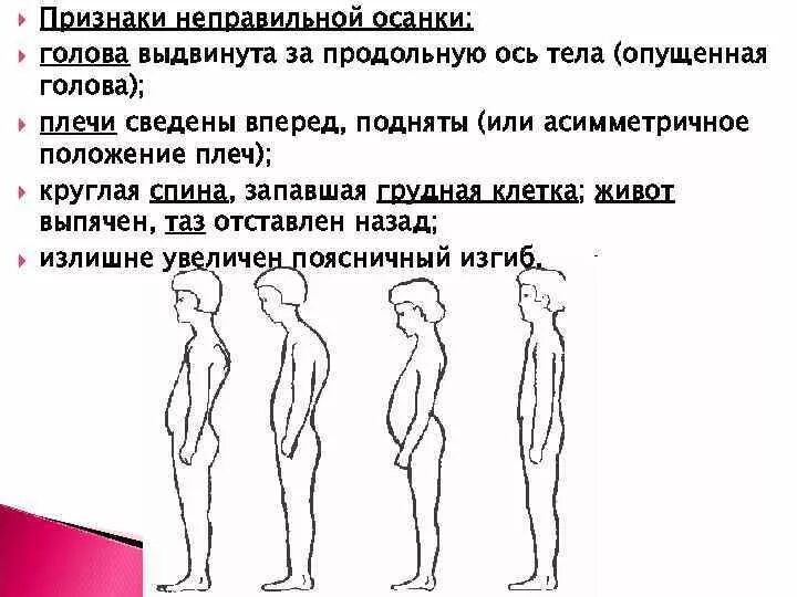 Признаки неправильной осанки. Асимметричное положение тела. Оси тела осанка. Голова выдвинута вперед.