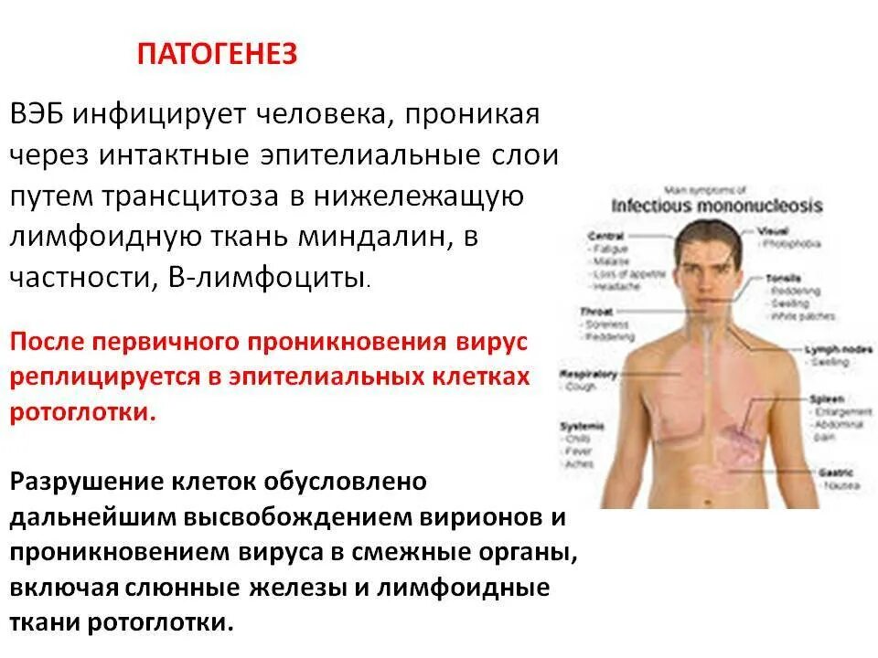 Инфекционный мононуклеоз - ОГБУЗ "Центр общественного здоровья и медицинской
