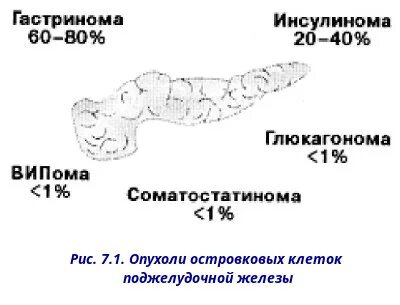 Антитела к островковым клеткам поджелудочной железы