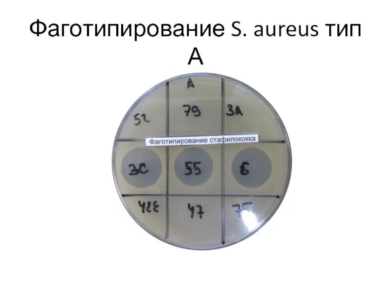 Реакция фаготипирования. Реакция фаготипирования