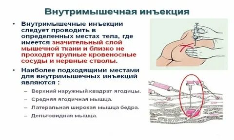 Внутримышечное введение ретиналамина
