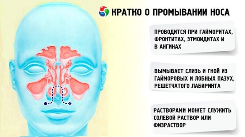 Почему закладывает нос в положении. Пазухи носа при промывании носа. Промыть гайморовы пазухи. Синусит промывание пазух носа.