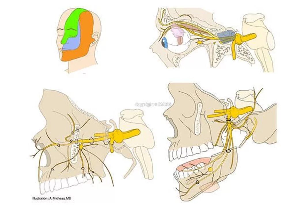 Повреждение тройничного. 2 Ветвь тройничного нерва анатомия. Анатомия человека тройничный нерв. Тройничный нерв и височно нижнечелюстной сустав. Тройничный нерв атлас Неттера.