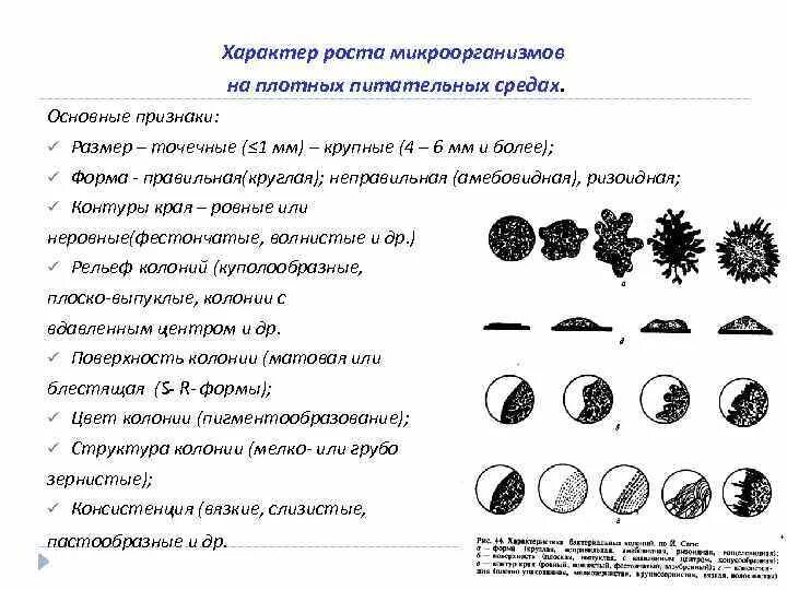 Рост бактерий на плотных питательных средах. Характер роста микроорганизмов на плотных питательных средах. Характер роста на плотных питательных средах. Характеристика колоний микроорганизмов.