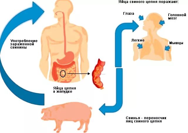 Может ли человек заразиться бычьим цепнем. Жизненный цикл свиного солитера схема. Источник заражения свиной цепень. Способ заражения свиного цепня. Свиной цепень поражаемые органы человека.