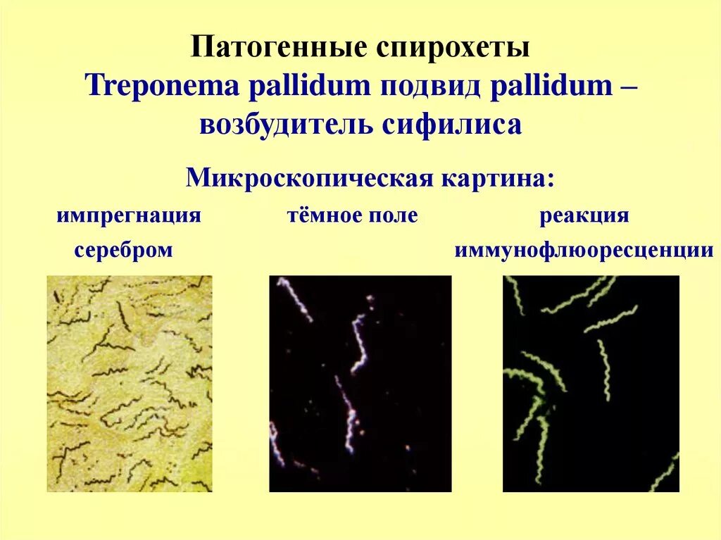 1 treponema pallidum. Treponema pallidum факторы патогенности. патогенные представители спирохет.