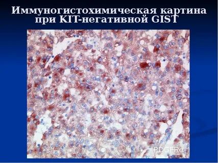 Иммуногистохимические антитела