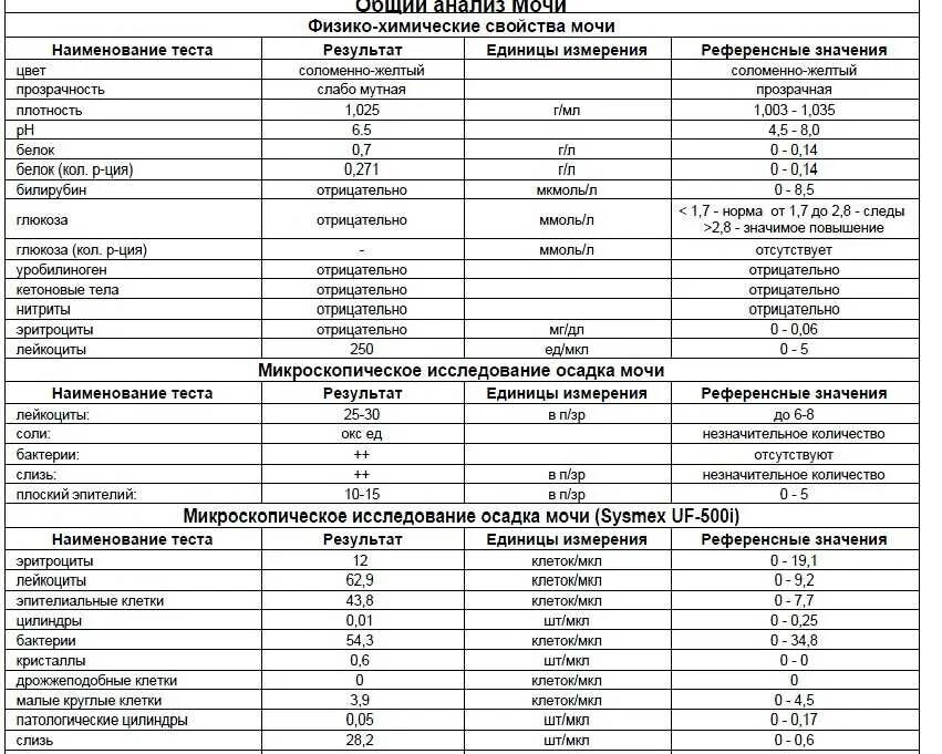 Общий белок в моче 1. Показатели микроскопического исследования мочи в норме. Показатели белка в моче норма таблица. Физико-химические показатели общего анализа мочи в норме:. Относительная плотность мочи норма у женщин.