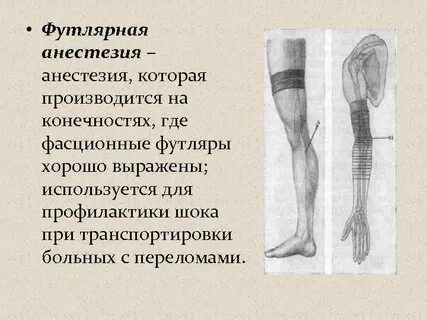 Анестезия конечностей