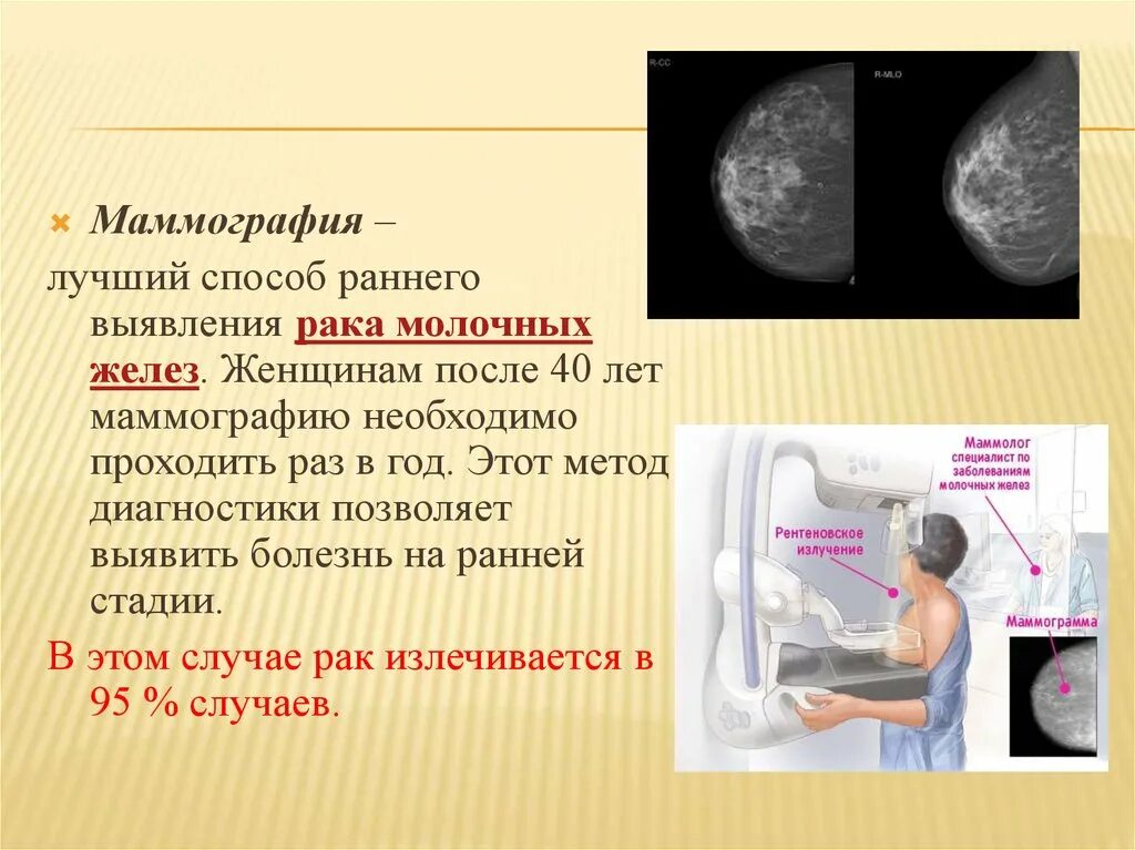 Маммография молочных желез после 40 лет