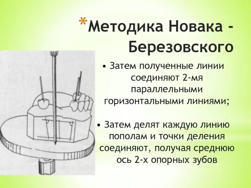 Параллелометрия. Метод параллелометрии в ортопедической стоматологии. параллелометрия бюгельного протеза. строение параллелометра. конструкция параллелометра.
