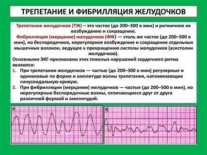 Ф п сердца