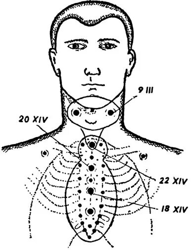 Точка высадки. Точки постановки пиявок на щитовидку. Массажные точки для щитовидной железы. Активные точки для постановки пиявок. Точки акупунктуры на грудной клетке.