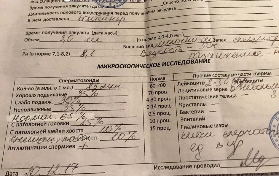 Спермограмма хорошие показатели таблица. Спермограмма методы исследования. Анализ на спермограмму. Спермограмма микроскопия. Показатели здоровой спермограммы.