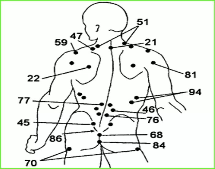 Больные места у человека. Акупунктура тела человека схема болевые точки. Болевые точки на теле человека для массажа. Болевые точки спины схема. Массаж спины схема болевые точки.