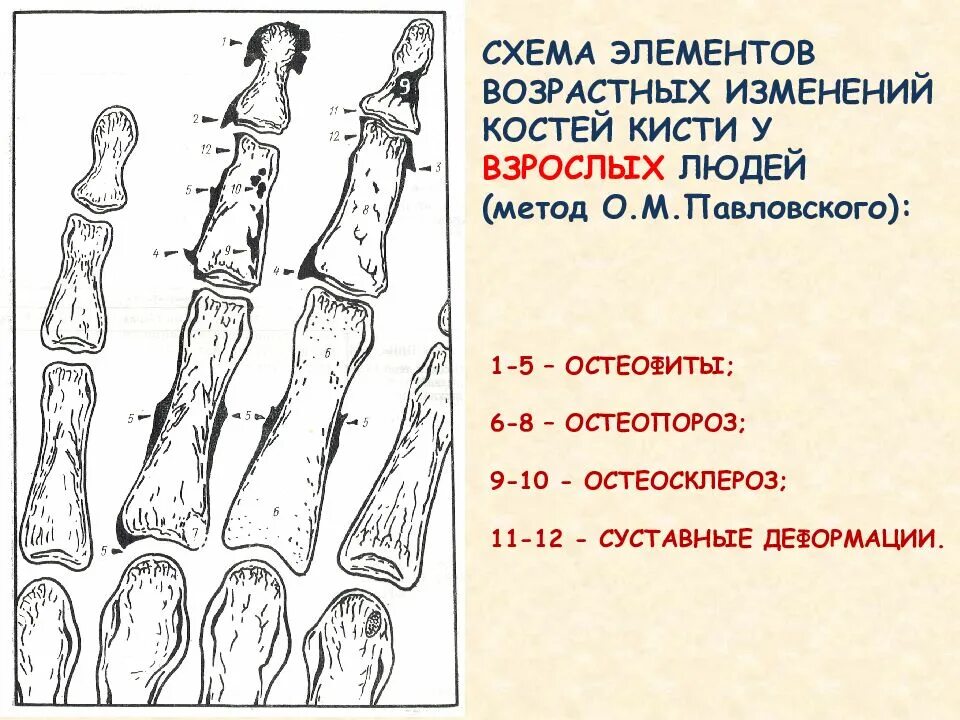 Признаком возрастных изменений костей является. Изменение костей. Возрастные изменения костей. Изменение костей с возрастом. Возрастные изменения костей человека.