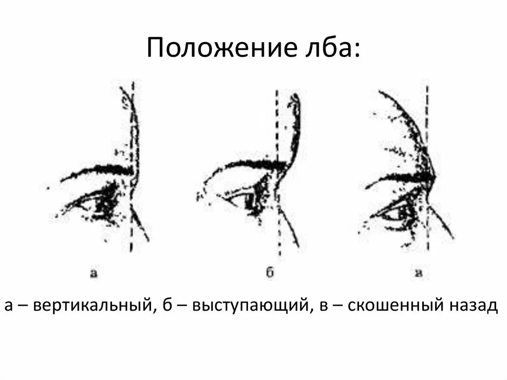 Положение лба. Положение лба криминалистика. Наклон положение лба. Лоб по положению скошенный вертикальный выступающий. Лоб по другому