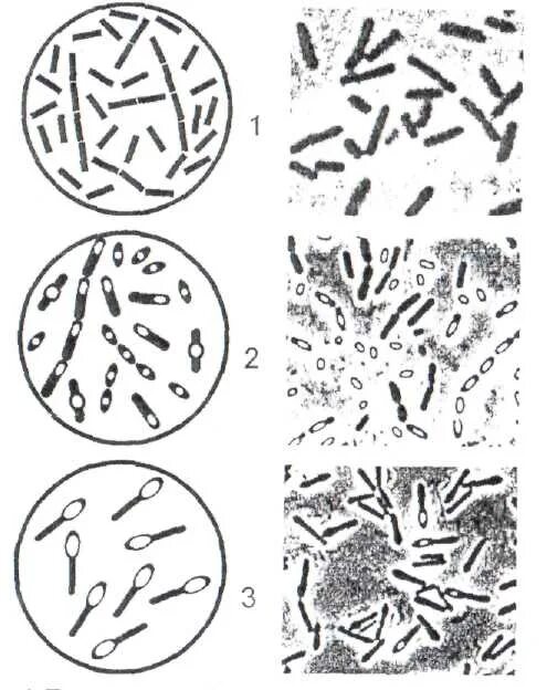 Бактерии бациллы клостридии. Палочковидными (бациллы, клостридии). Clostridium tetani микроскопия. Спорообразующие бактерии бациллы клостридии. Бактерии бациллы клостридии.