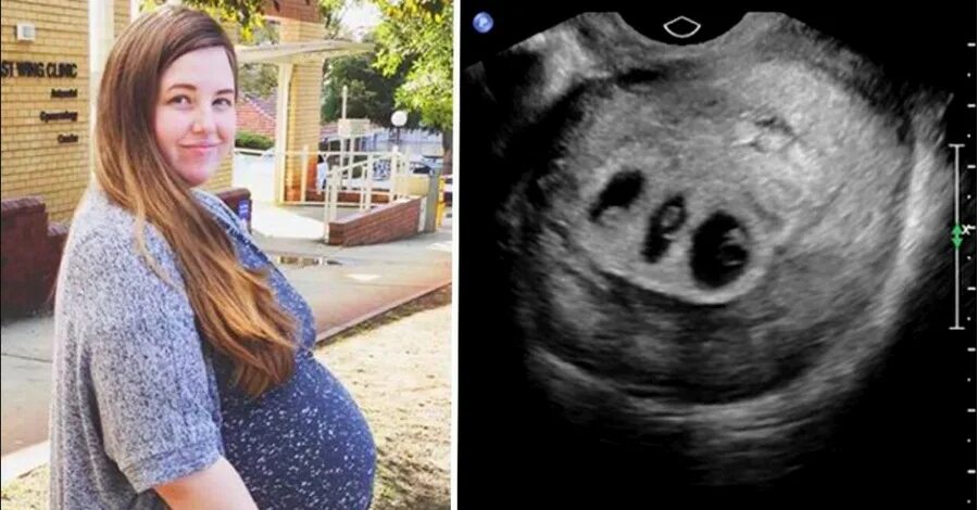 к чему снится беременность тройней. к чему снится беременность тройней. самые большие беременные животы. к чему снится беременность тройней. женщина беременная двойней.