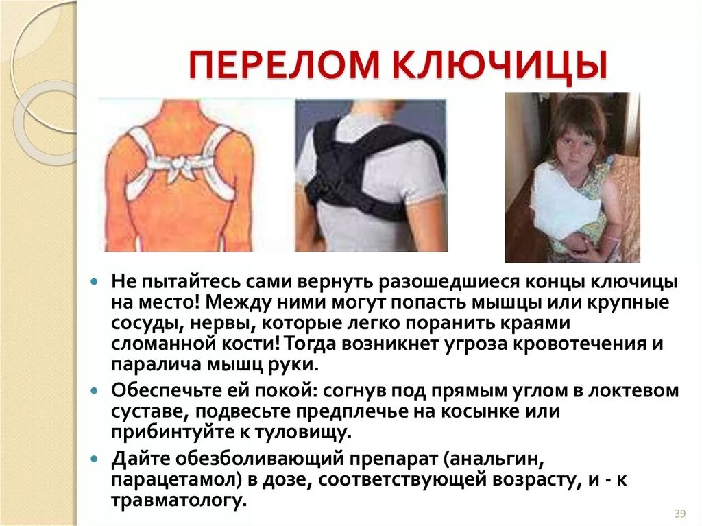 Перелом ключицы у ребенка рентген. Повязка при переломе ключицы. Лечение перелома ключицы у детей. Лечение перелома ключицы у детей. Перелом ключицы повязка.