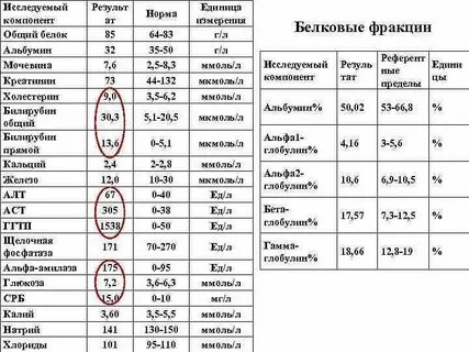 Норма общего содержания это