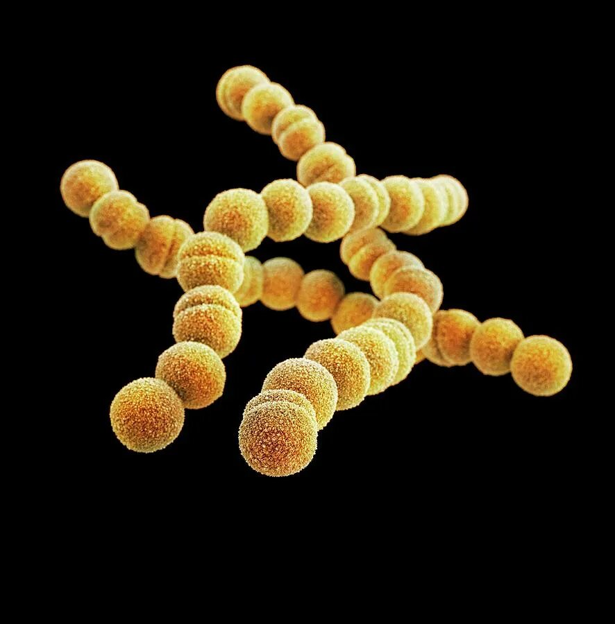 Streptococcus. Streptococcus pyogenes это стрептококк. стрептококк пиогенес (streptococcus pyogenes. стрептококк фациалис. бактерий стрептококк пиогенес.