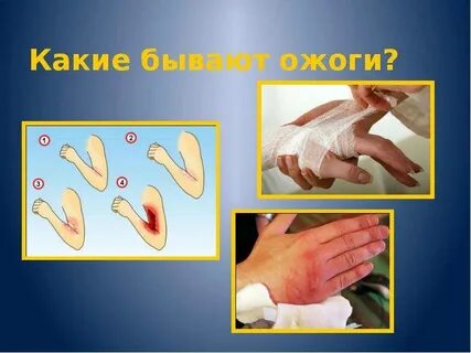 Обожгло какое время