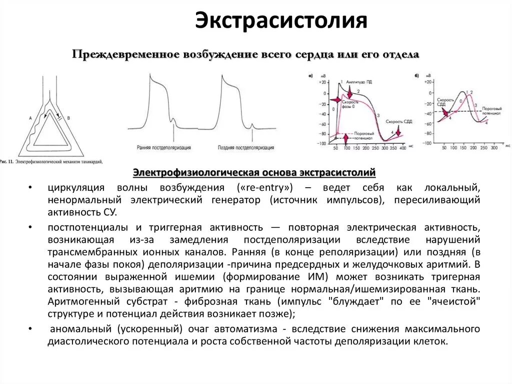 Вагоинсулярный вегетативный криз. Замирание сердца симптомы причины. Экстрасистола физиология механизм. Перебои в работе сердца замирание. Аритмическая форма инфаркта миокарда симптомы.
