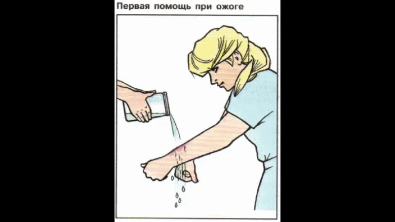 Ожоги теплового удара