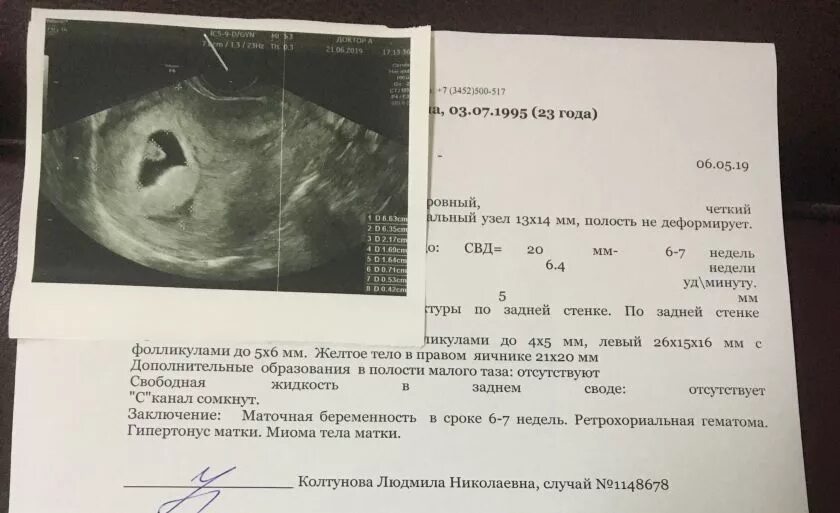 Шейка матки во втором триместре беременности. Гипертонус матки при беременности 1 триместр узи. гипертонус матки при беременности 2 триместр узи. гипертонус матки по узи. гипертонус матки на узи при беременности.